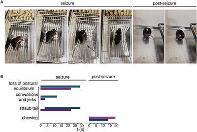 p53-Sensitive Epileptic Behavior and Inflammation in Ft1 Hypomorphic Mice